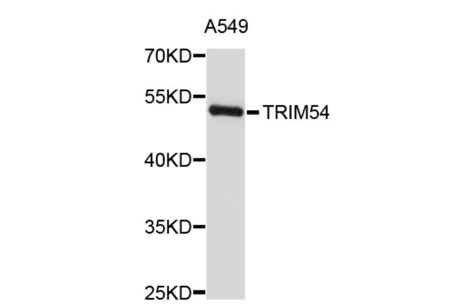 Western Blot - Anti-TRIM54 Antibody (A3470) - Antibodies.com