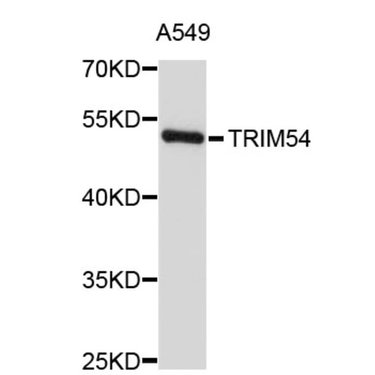 Western Blot - Anti-TRIM54 Antibody (A3470) - Antibodies.com