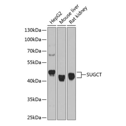 Western Blot - Anti-SUGCT Antibody (A9220) - Antibodies.com