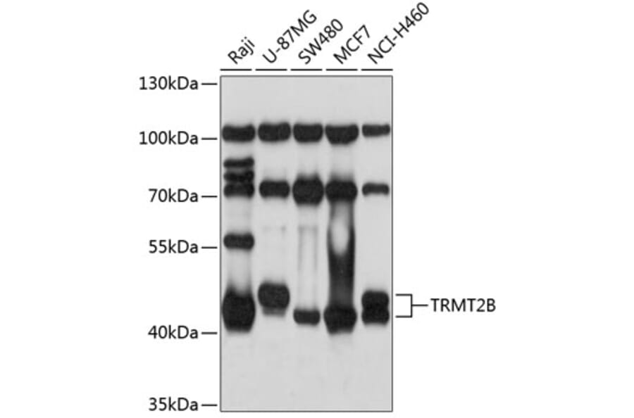 Western Blot - Anti-TRMT2B Antibody (A9221) - Antibodies.com