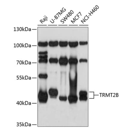 Western Blot - Anti-TRMT2B Antibody (A9221) - Antibodies.com