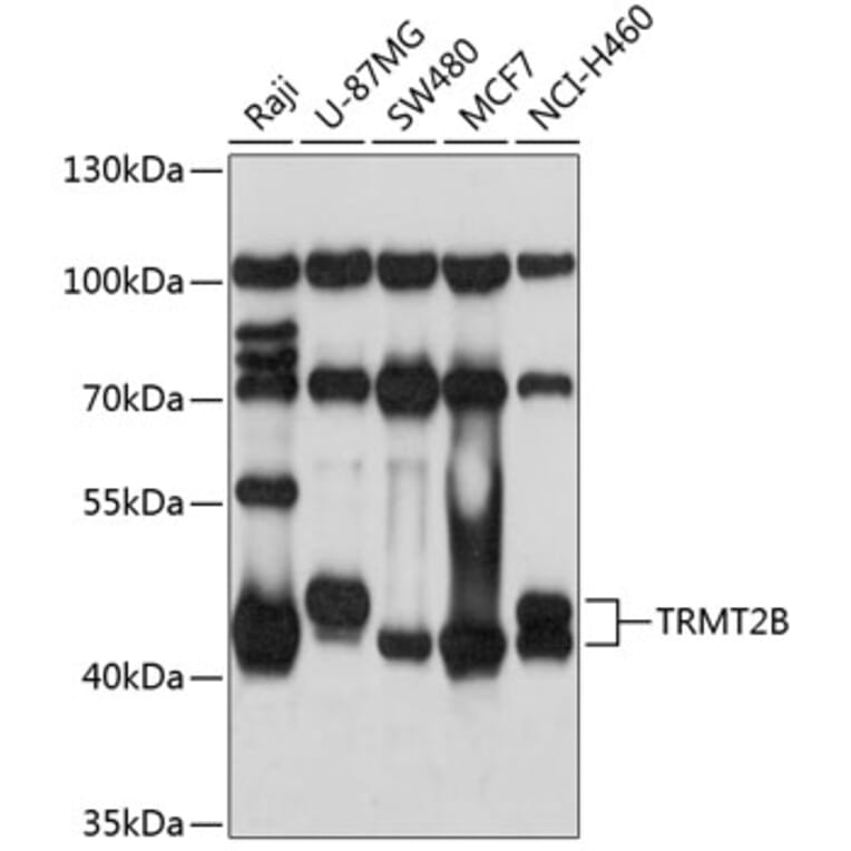 Western Blot - Anti-TRMT2B Antibody (A9221) - Antibodies.com