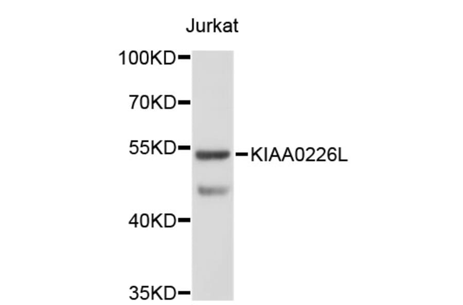 Western Blot - Anti-KIAA0226L Antibody (A3513) - Antibodies.com