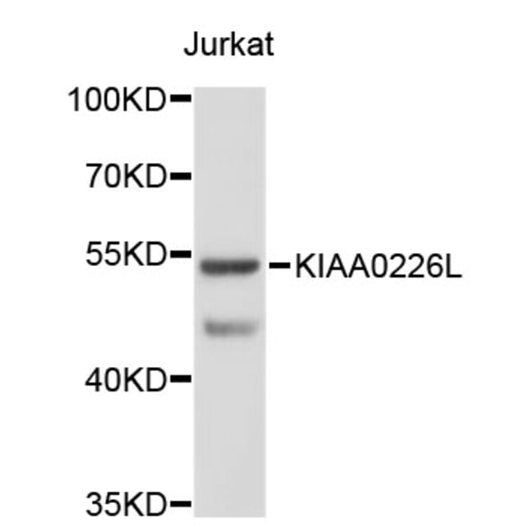 Western Blot - Anti-KIAA0226L Antibody (A3513) - Antibodies.com