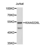 Western Blot - Anti-KIAA0226L Antibody (A3513) - Antibodies.com