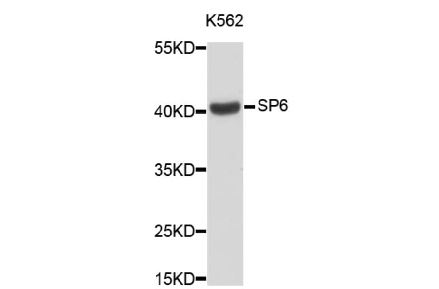 Western Blot - Anti-SP6 Antibody (A3515) - Antibodies.com