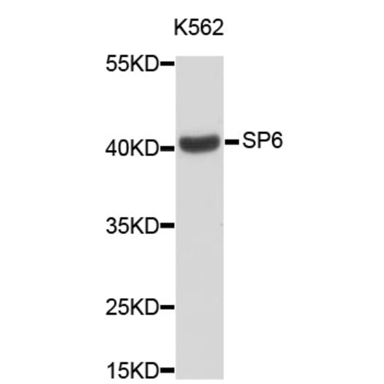 Western Blot - Anti-SP6 Antibody (A3515) - Antibodies.com