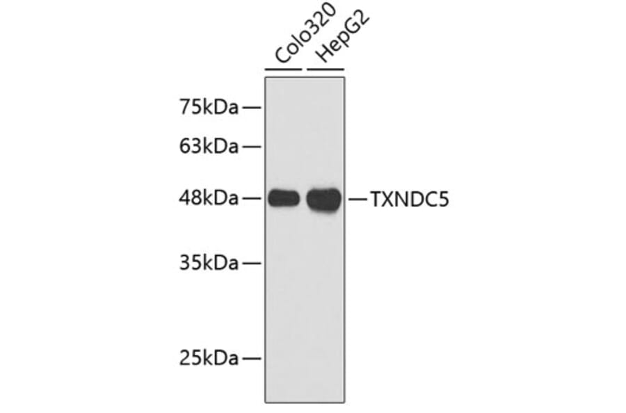 Western Blot - Anti-TXNDC5 Antibody (A3516) - Antibodies.com