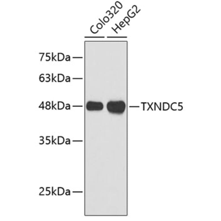 Western Blot - Anti-TXNDC5 Antibody (A3516) - Antibodies.com