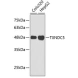 Western Blot - Anti-TXNDC5 Antibody (A3516) - Antibodies.com