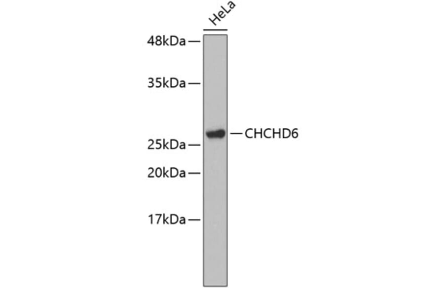 Western Blot - Anti-CHCHD6 Antibody (A3525) - Antibodies.com