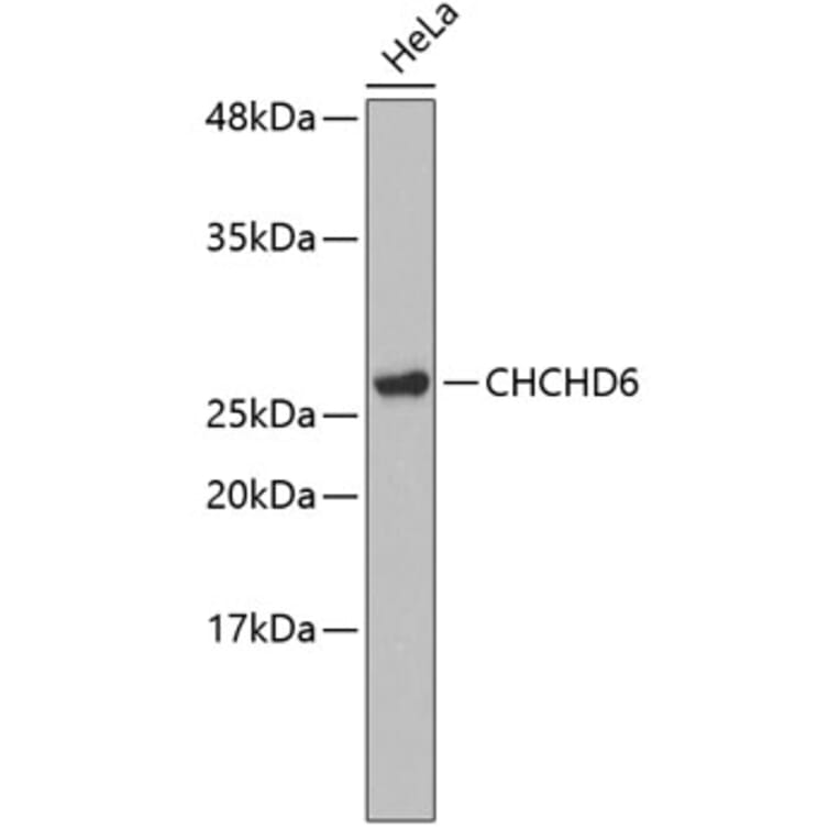 Western Blot - Anti-CHCHD6 Antibody (A3525) - Antibodies.com