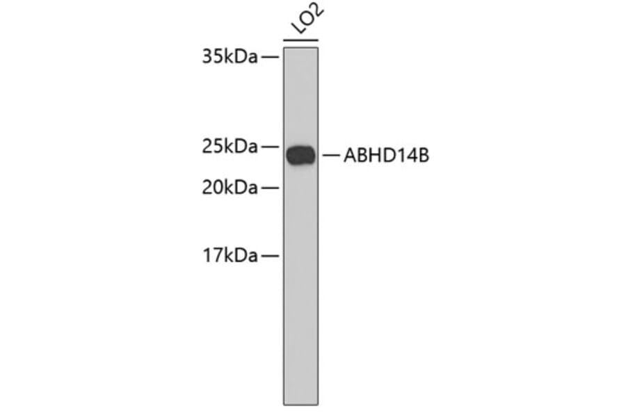 Western Blot - Anti-ABHD14B Antibody (A3532) - Antibodies.com