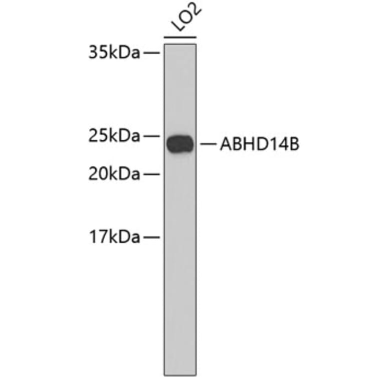 Western Blot - Anti-ABHD14B Antibody (A3532) - Antibodies.com
