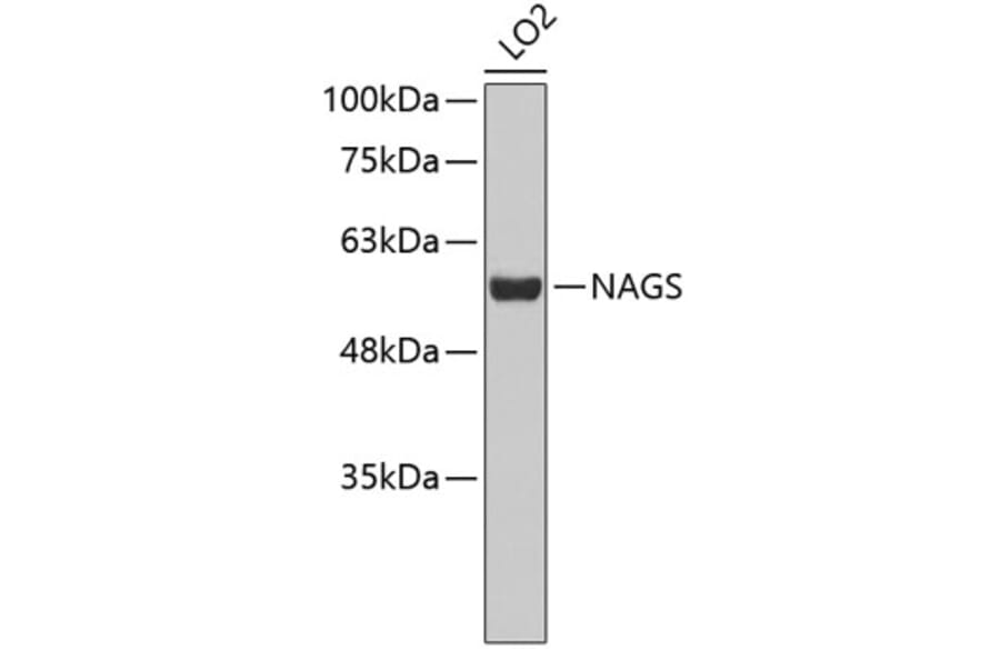Western Blot - Anti-NAGS Antibody (A3555) - Antibodies.com