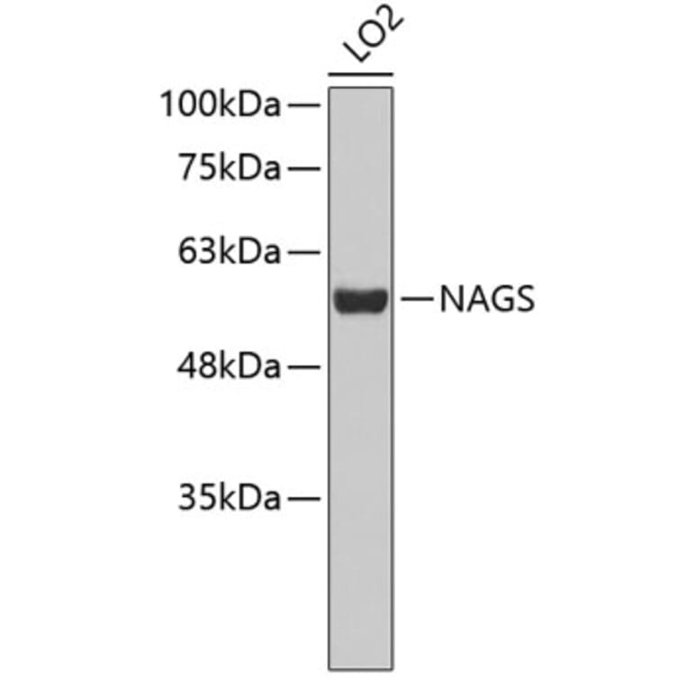 Western Blot - Anti-NAGS Antibody (A3555) - Antibodies.com