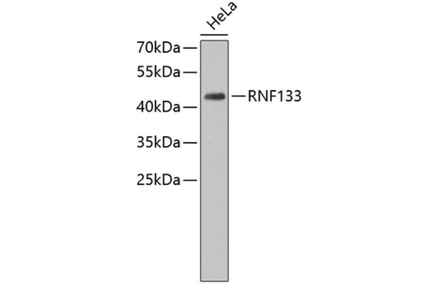 Western Blot - Anti-RNF133 Antibody (A3558) - Antibodies.com