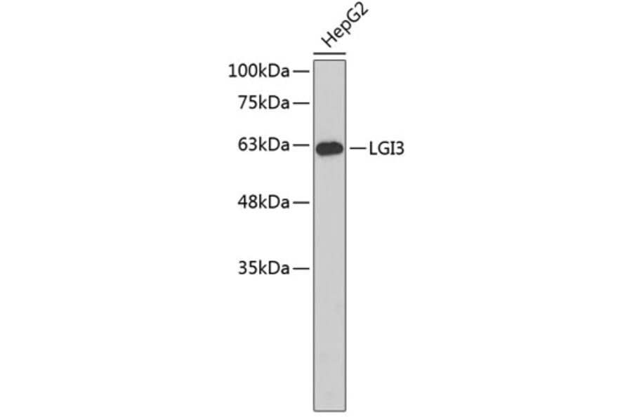 Western Blot - Anti-LGI3 Antibody (A3561) - Antibodies.com