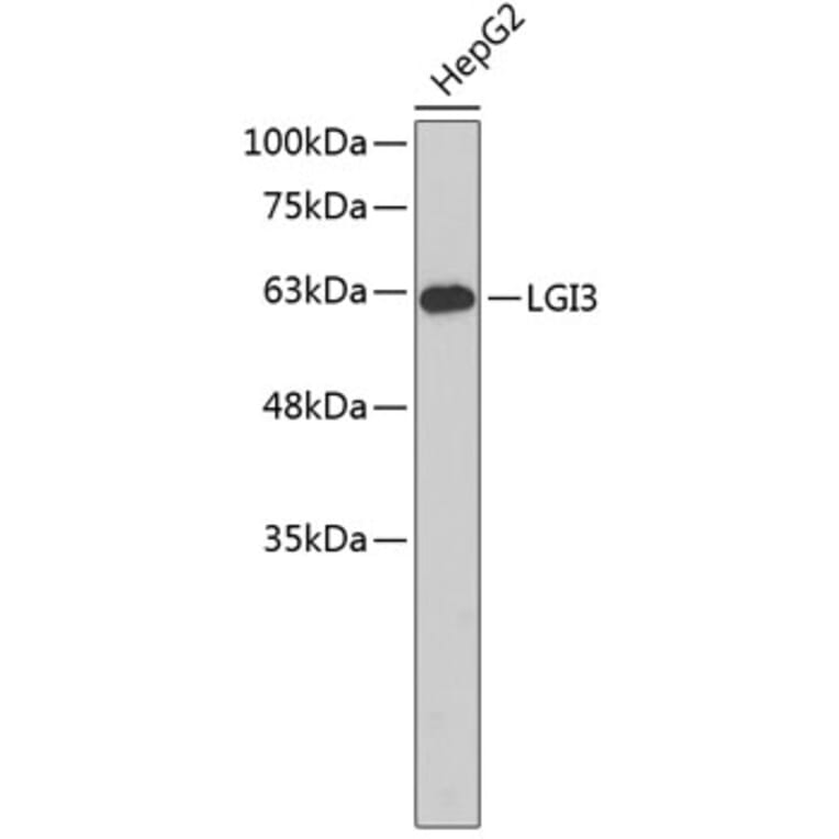 Western Blot - Anti-LGI3 Antibody (A3561) - Antibodies.com