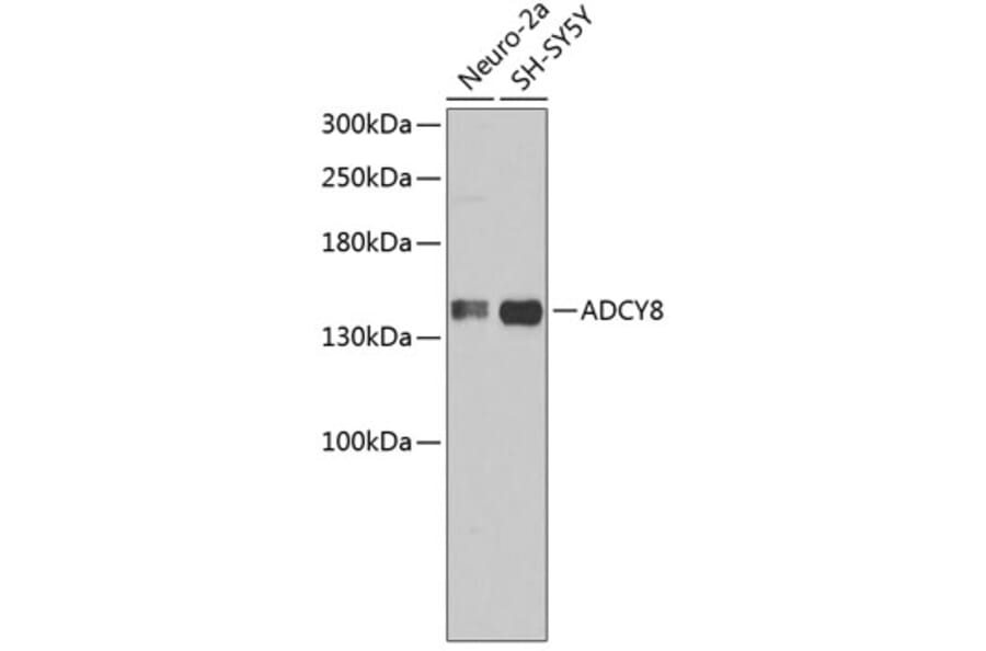 Western Blot - Anti-ADCY8 Antibody (A3582) - Antibodies.com