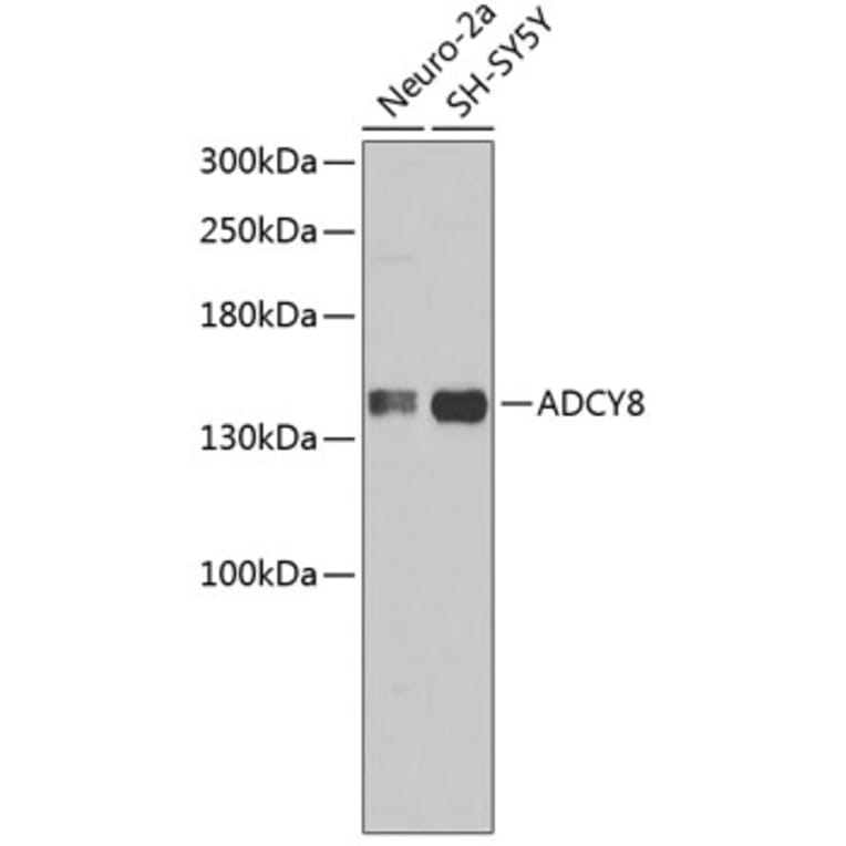 Western Blot - Anti-ADCY8 Antibody (A3582) - Antibodies.com