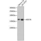 Western Blot - Anti-ADCY8 Antibody (A3582) - Antibodies.com