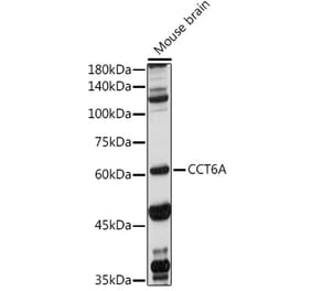 Western Blot - Anti-CCT6A Antibody (A9234) - Antibodies.com
