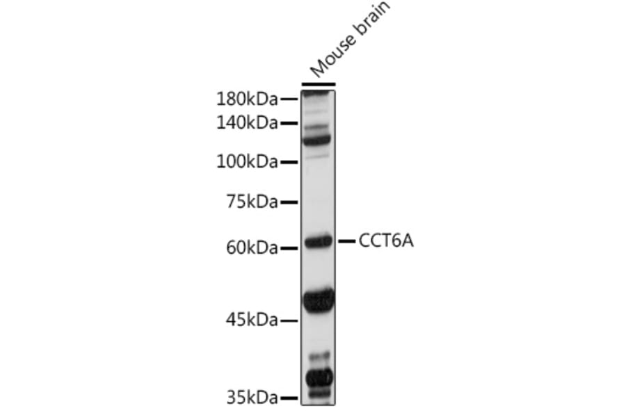 Western Blot - Anti-CCT6A Antibody (A9234) - Antibodies.com