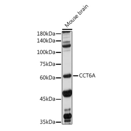 Western Blot - Anti-CCT6A Antibody (A9234) - Antibodies.com