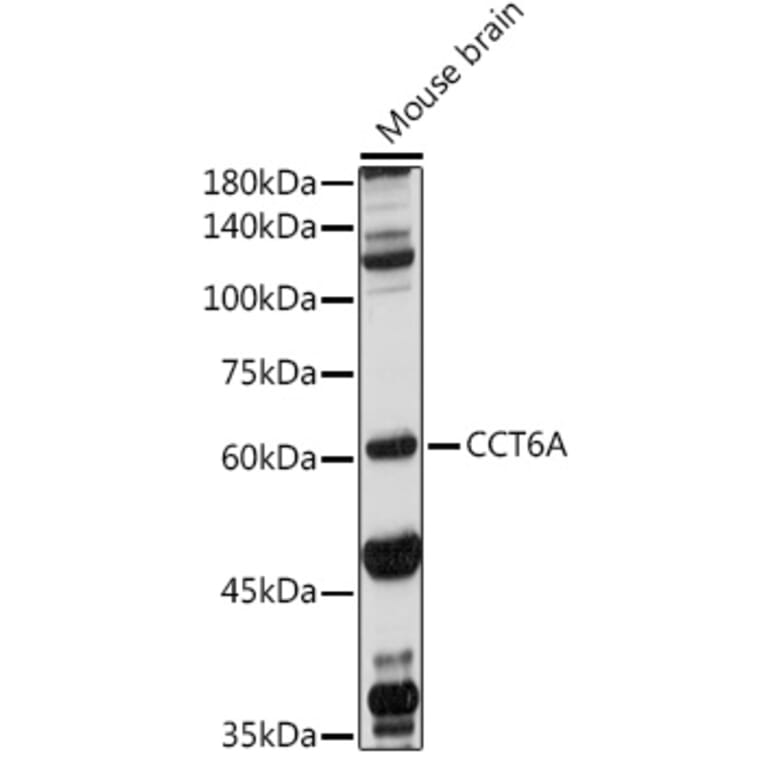 Western Blot - Anti-CCT6A Antibody (A9234) - Antibodies.com