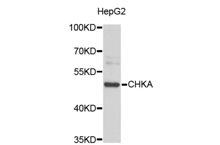 Western Blot - Anti-CHKA Antibody (A3590) - Antibodies.com