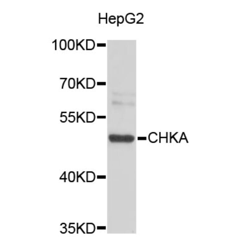 Western Blot - Anti-CHKA Antibody (A3590) - Antibodies.com