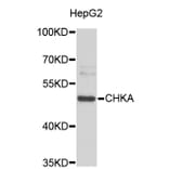 Western Blot - Anti-CHKA Antibody (A3590) - Antibodies.com