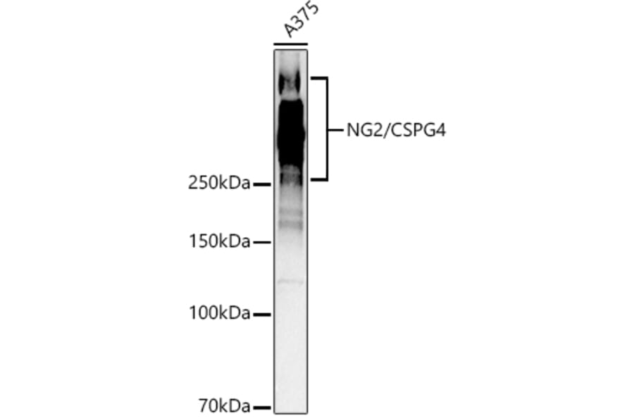 Western Blot - Anti-NG2 Antibody (A9236) - Antibodies.com