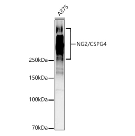 Western Blot - Anti-NG2 Antibody (A9236) - Antibodies.com