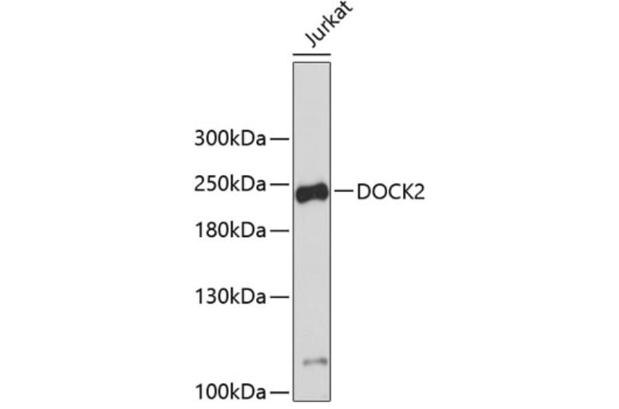Western Blot - Anti-DOCK2 Antibody (A9237) - Antibodies.com