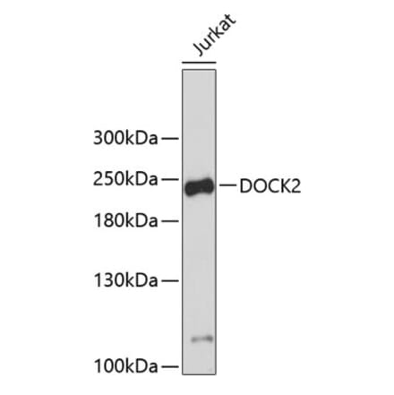 Western Blot - Anti-DOCK2 Antibody (A9237) - Antibodies.com