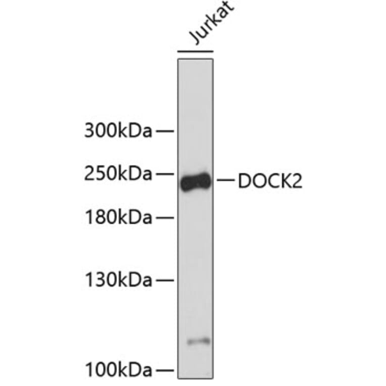 Western Blot - Anti-DOCK2 Antibody (A9237) - Antibodies.com