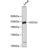 Western Blot - Anti-DOCK2 Antibody (A9237) - Antibodies.com