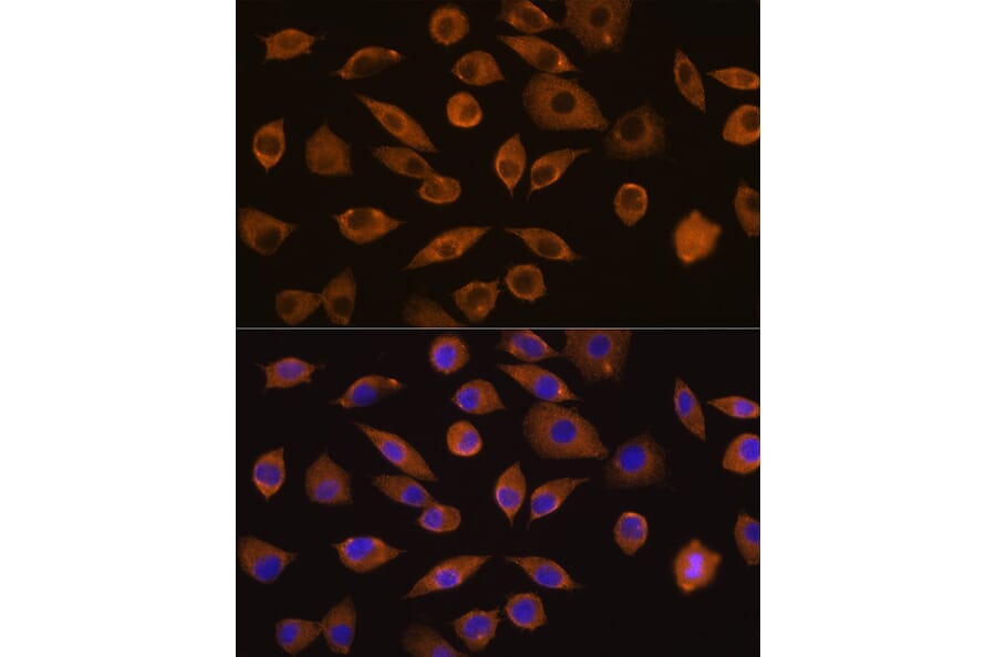 Immunofluorescence - Anti-DOCK2 Antibody (A9237) - Antibodies.com