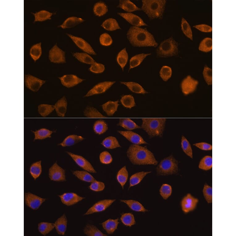 Immunofluorescence - Anti-DOCK2 Antibody (A9237) - Antibodies.com