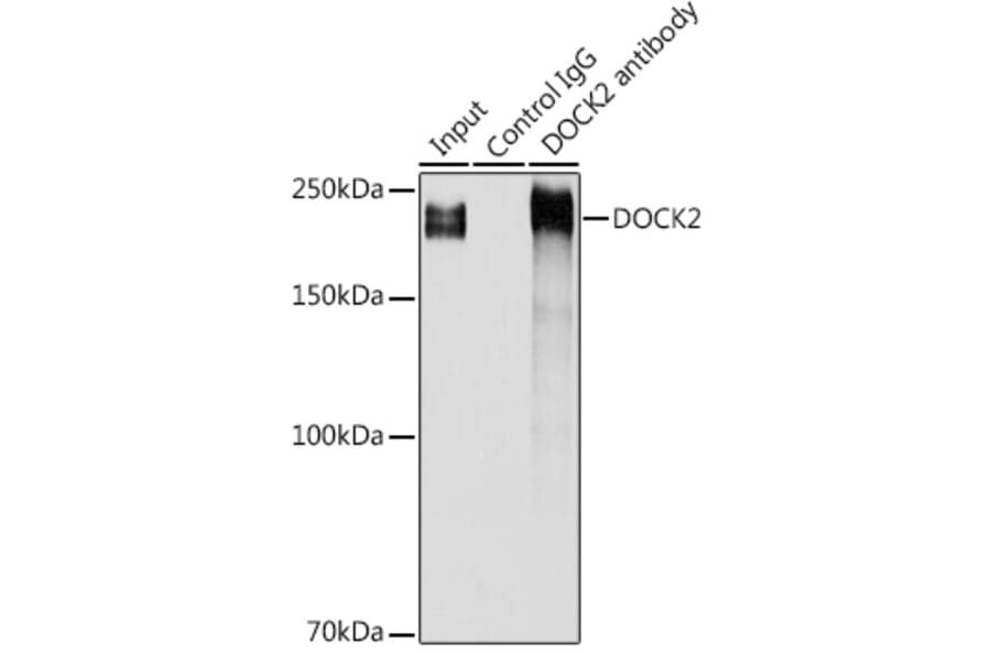 Western Blot - Anti-DOCK2 Antibody (A9237) - Antibodies.com