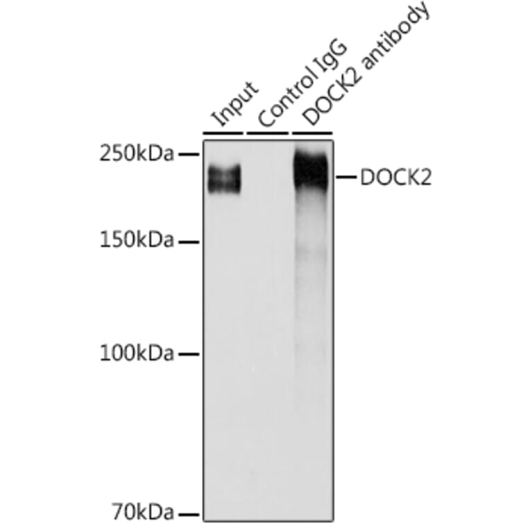 Western Blot - Anti-DOCK2 Antibody (A9237) - Antibodies.com