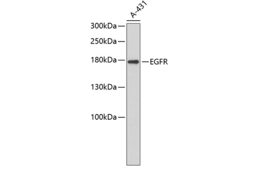 Western Blot - Anti-EGFR Antibody (A3598) - Antibodies.com