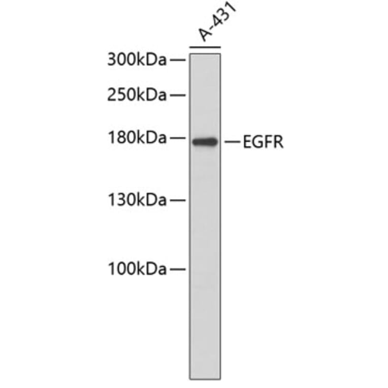 Western Blot - Anti-EGFR Antibody (A3598) - Antibodies.com