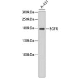Western Blot - Anti-EGFR Antibody (A3598) - Antibodies.com