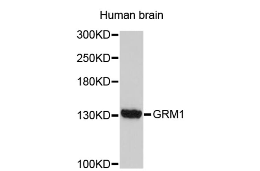 Western Blot - Anti-GRM1 Antibody (A3604) - Antibodies.com