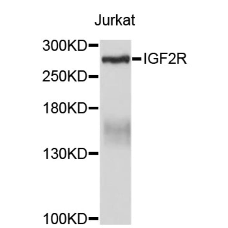 Western Blot - Anti-IGF2R Antibody (A3610) - Antibodies.com