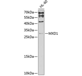 Western Blot - Anti-MXD1 Antibody (A3613) - Antibodies.com