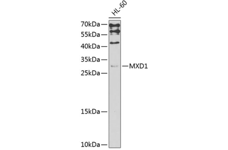 Western Blot - Anti-MXD1 Antibody (A3613) - Antibodies.com